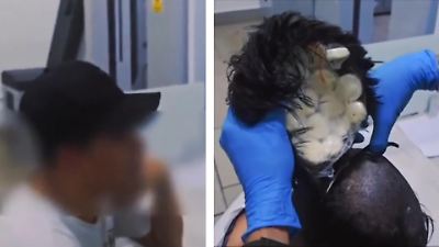 Kolumbien: Kokain-Toupet! Mann klebt sich Drogen auf den Kopf