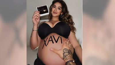 Lisa Straube hat Schmerzen bei jedem Schritt: Bandscheibenvorfall