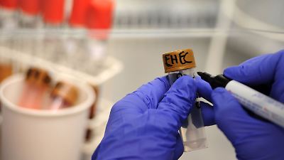 Neue EHEC-Fälle in Mecklenburg-Vorpommern! Behörde spricht von „Ausbruch”